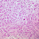Imagen para el artículo titulado El cáncer de mama se propaga más rápido mientras duermes